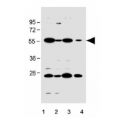 Western blot testing of human 1) HT-1080, 2) HepG2, 3) K562 and 4) Caco-2 cell lysate with SLC10A1 antibody. Expected molecular weight: 38~45 kDa.