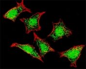 Immunofluorescent staining of fixed and permeabilized human HeLa cells with Natriuretic peptide receptor C antibody (green) and Hoechst 33342 nuclear stain (blue).