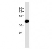 Western blot testing of human HACAT cell lysate with MARCO antibody. Predicted molecular weight ~53 kDa and ~44 kDa (two isoforms).