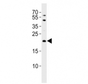 Western blot testing of human MCF7 cell lysate with TIMM23 antibody. Predicted molecular weight ~22 kDa.
