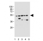 Western blot testing of human 1) HeLa, 2) U-251 MG, 3) U-87 MG, 4) U-2 OS and 5) MCF7 cell lysate with Gasdermin E antibody. Predicted molecular weight ~55 kDa.