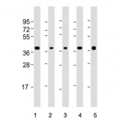 Western blot testing of human 1) Raji, 2) Jurkat, 3) K562, 4) MCF7 and 5) HL60 cell lysate with SELL antibody. Expected/observed molecular weight: 42~95 kDa depending on level of glycosylation.
