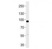 Western blot testing of human A431 cell lysate with C1S antibody. Predicted molecular weight ~77 kDa but may be observed at higher molecular weights due to glycosylation.
