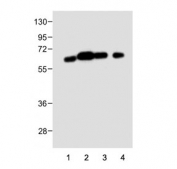 Western blot testing of human 1) HepG2, 2) A549, 3) HT-29 and 4) OVCAR3 cell lysate with CYP3A4 antibody. Expected molecular weight: 50-57 kDa.