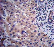 IHC staining of FFPE human liver tissue with CYP3A4 antibody. HIER: steam section in pH6 citrate buffer for 20 min and allow to cool prior to staining.