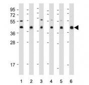 Western blot testing of human 1) HL60, 2) CCRF-CEM, 3) Jurkat, 4) Ramos, 5) A375 and 6) A2058 cell lysate with HLA-B antibody. Predicted molecular weight 40-45 kDa depending on level of glycosylation.
