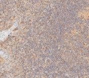 IHC testing of FFPE human tonsil tissue with HLA-B antibody. HIER: steam section in pH6 citrate buffer for 20 min and allow to cool prior to staining.