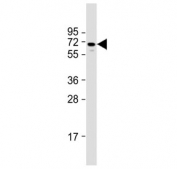 Western blot testing of human HepG2 cell lysate with NUAK1 antibody. Predicted molecular weight ~74 kDa.