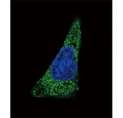 Immunofluorescent staining of fixed and permeabilized human HepG2 cells with SLC11A2 antibody (green) and DAPI nuclear stain (blue).