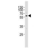 Western blot testing of mouse liver tissue lysate with ACVR2A antibody. Predicted molecular weight ~58 kDa.