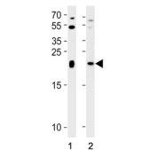 Western blot testing of human 1) K562 and 2) placenta tissue lysate with IL-31 antibody. Predicted molecular weight ~18 kDa.