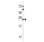Western blot testing of mouse Neuro-2a cell lysate with SCN1B antibody. Predicted molecular weight: 24-30 kDa but can be observed at 30-40 kDa.