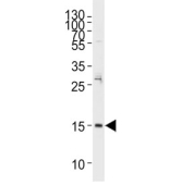 Western blot testing of human RPMI-8226 cell lysate with REG3A antibody. Predicted molecular weight ~19 kDa, but smaller forms of this protein can be observed.