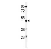 Western blot testing of mouse liver tissue lysate with GSDMA antibody. Predicted molecular weight ~49 kDa.