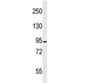 Western blot testing of human HL60 cell lysate with CAPN3 antibody. Predicted molecular weight ~94 kDa.