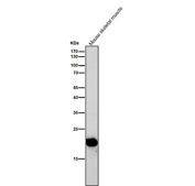All lanes use the antibody at 1:1K dilution for 1 hour at room temperature. Predicted molecular weight ~18 kDa.