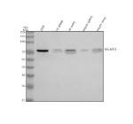 Western blot analysis of GALNT15 using anti-GALNT15 antibody. Lane 1: human 293T whole cell lysates, Lane 2: rat spleen tissue lysates, Lane 3: rat ovary tissue lysates, Lane 4: mouse spleen tissue lysates, Lane 5: mouse ovary tissue lysates. After electrophoresis, proteins were transferred to a nitrocellulose membrane at 150 mA for 50-90 minutes. Blocked the membrane with 5% non-fat milk/TBS for 1.5 hour at RT. The membrane was incubated with rabbit anti-GALNT15 antibody at 0.5 ug/ml overnight at 4oC, then washed with TBS-0.1%Tween 3 times with 5 minutes each and probed with a goat anti-rabbit IgG-HRP secondary antibody at a dilution of 1:5000 for 1.5 hour at RT. The signal was developed using enhanced chemiluminescent. A specific band was detected for GALNT15 at approximately 73 kDa. The expected band size for GALNT15 is at 73 kDa.