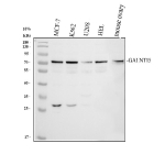 Western blot analysis of GALNT15 using anti-GALNT15 antibody. Electrophoresis was performed on a 10% SDS-PAGE gel at 80V (Stacking gel) / 120V (Resolving gel) for 2 hours. Lane 1: human MCF-7 whole cell lysates, Lane 2: human K562 whole cell lysates, Lane 3: human U2OS whole cell lysates, Lane 4: human HEL whole cell lysates, Lane 5: mouse ovary tissue lysates. After electrophoresis, proteins were transferred to a nitrocellulose membrane at 150 mA for 50-90 minutes. Blocked the membrane with 5% non-fat milk/TBS for 1.5 hour at RT. The membrane was incubated with rabbit anti-GALNT15 antibody at 0.5 ug/ml overnight at 4oC, then washed with TBS-0.1%Tween 3 times with 5 minutes each and probed with a goat anti-rabbit IgG-HRP secondary antibody at a dilution of 1:5000 for 1.5 hour at RT. The signal is developed using an ECL Plus Western Blotting Substratewith Tanon 5200 system. A specific band was detected for GALNT15 at approximately 73 kDa. The expected band size for GALNT15 is at 73 kDa.