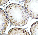 IHC analysis of RBBP6 using anti-RBBP6 antibody. RBBP6 was detected in a paraffin-embedded section of rat testis tissue. Heat mediated antigen retrieval was performed in EDTA buffer (pH 8.0, epitope retrieval solution). The tissue section was blocked with 10% goat serum. The tissue section was then incubated with 2 ug/ml rabbit anti-RBBP6 antibody overnight at 4oC. Peroxidase Conjugated Goat Anti-rabbit IgG was used as secondary antibody and incubated for 30 minutes at 37oC. The tissue section was developed using an HRP secondary and DAB substrate.