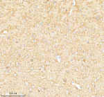 IHC analysis of SYNPR using anti-SYNPR antibody. SYNPR was detected in a paraffin-embedded section of rat brain tissue. Heat mediated antigen retrieval was performed in EDTA buffer (pH 8.0, epitope retrieval solution). The tissue section was blocked with 10% goat serum. The tissue section was then incubated with 2 ug/ml rabbit anti-SYNPR antibody overnight at 4oC. Peroxidase Conjugated Goat Anti-rabbit IgG was used as secondary antibody and incubated for 30 minutes at 37oC. The tissue section was developed using an HRP secondary and DAB substrate.