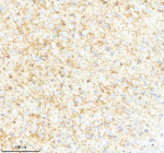 IHC analysis of SYNPR using anti-SYNPR antibody. SYNPR was detected in a paraffin-embedded section of mouse brain tissue. Heat mediated antigen retrieval was performed in EDTA buffer (pH 8.0, epitope retrieval solution). The tissue section was blocked with 10% goat serum. The tissue section was then incubated with 2 ug/ml rabbit anti-SYNPR antibody overnight at 4oC. Peroxidase Conjugated Goat Anti-rabbit IgG was used as secondary antibody and incubated for 30 minutes at 37oC. The tissue section was developed using an HRP secondary and DAB substrate.
