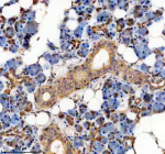 IHC analysis of TMED10 using anti-TMED10 antibody. TMED10 was detected in a paraffin-embedded section of human parotid gland tissue. Heat mediated antigen retrieval was performed in EDTA buffer (pH 8.0, epitope retrieval solution). The tissue section was blocked with 10% goat serum. The tissue section was then incubated with 2 ug/ml rabbit anti-TMED10 antibody overnight at 4oC. Peroxidase Conjugated Goat Anti-rabbit IgG was used as secondary antibody and incubated for 30 minutes at 37oC. The tissue section was developed using an HRP secondary and DAB substrate.