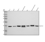 Western blot analysis of TMED10 using anti-TMED10 antibody. Electrophoresis was performed on a 12% SDS-PAGE gel at 80V (Stacking gel) / 120V (Resolving gel) for 2 hours. Lane 1: human PC-3 whole cell lysates, Lane 2: human 293T whole cell lysates, Lane 3: human THP-1 whole cell lysates, Lane 4: rat pancreas tissue lysates, Lane 5: rat C6 whole cell lysates, Lane 6: mouse pancreas tissue lysates, Lane 7: mouse NIH/3T3 whole cell lysates. After electrophoresis, proteins were transferred to a nitrocellulose membrane at 150 mA for 50-90 minutes. Blocked the membrane with 5% non-fat milk/TBS for 1.5 hour at RT. The membrane was incubated with rabbit anti-TMED10 antibody at 0.5 ug/ml overnight at 4oC, then washed with TBS-0.1%Tween 3 times with 5 minutes each and probed with a goat anti-rabbit IgG-HRP secondary antibody at a dilution of 1:5000 for 1.5 hour at RT. The signal was developed using an ECL Plus Western Blotting Substrate. The expected band size for TMED10 is at 25 kDa.