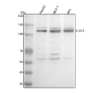 Western blot analysis of LLGL2 using anti-LLGL2 antibody. Lane 1: human HepG2 whole cell lysates, Lane 2: human MCF-7 whole cell lysates, Lane 3: human RT4 whole cell lysates. After electrophoresis, proteins were transferred to a nitrocellulose membrane at 150 mA for 50-90 minutes. Blocked the membrane with 5% non-fat milk/TBS for 1.5 hour at RT. The membrane was incubated with rabbit anti-LLGL2 antibody at 0.5 ug/ml overnight at 4oC, then washed with TBS-0.1%Tween 3 times with 5 minutes each and probed with a goat anti-rabbit IgG-HRP secondary antibody at a dilution of 1:5000 for 1.5 hour at RT. The signal was developed using enhanced chemiluminescent. The expected band size for LLGL2 is at 113 kDa.