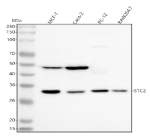 Western blot analysis of STC2 using anti-STC2 antibody. Lane 1: human MCF-7 whole cell lysates, Lane 2: human Caco-2 whole cell lysates, Lane 3: rat PC-12 whole cell lysates, Lane 4: mouse Raw264.7 whole cell lysates. After electrophoresis, proteins were transferred to a nitrocellulose membrane at 150 mA for 50-90 minutes. Blocked the membrane with 5% non-fat milk/TBS for 1.5 hour at RT. The membrane was incubated with rabbit anti-STC2 antibody at 0.5 ug/ml overnight at 4oC, then washed with TBS-0.1%Tween 3 times with 5 minutes each and probed with a goat anti-rabbit IgG-HRP secondary antibody at a dilution of 1:5000 for 1.5 hour at RT. The signal was developed using enhanced chemiluminescent. The expected band size for STC2 is at 33 kDa and the protein may be observed at higher molecular weights due to glycosylation.
