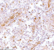 IHC analysis of STC2 using anti-STC2 antibody. STC2 was detected in a paraffin-embedded section of human testicular seminoma tissue. Heat mediated antigen retrieval was performed in EDTA buffer (pH 8.0, epitope retrieval solution). The tissue section was blocked with 10% goat serum. The tissue section was then incubated with 2 ug/ml rabbit anti-STC2 antibody overnight at 4oC. Peroxidase Conjugated Goat Anti-rabbit IgG was used as secondary antibody and incubated for 30 minutes at 37oC. The tissue section was developed using an HRP secondary and DAB substrate.