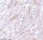 IHC analysis of STC2 using anti-STC2 antibody. STC2 was detected in a paraffin-embedded section of human testicular seminoma tissue. Heat mediated antigen retrieval was performed in EDTA buffer (pH 8.0, epitope retrieval solution). The tissue section was blocked with 10% goat serum. The tissue section was then incubated with 2 ug/ml rabbit anti-STC2 antibody overnight at 4oC. Peroxidase Conjugated Goat Anti-rabbit IgG was used as secondary antibody and incubated for 30 minutes at 37oC. The tissue section was developed using an HRP secondary and DAB substrate.