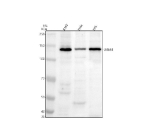 Western blot analysis of UBE4B using anti-UBE4B antibody. Electrophoresis was performed on a 8% SDS-PAGE gel at 80V (Stacking gel) / 120V (Resolving gel) for 2 hours. Lane 1: human K562 whole cell lysates, Lane 2: human Hela whole cell lysates, Lane 3: human HEL whole cell lysates. After electrophoresis, proteins were transferred to a nitrocellulose membrane at 150 mA for 50-90 minutes. Blocked the membrane with 5% non-fat milk/TBS for 1.5 hour at RT. The membrane was incubated with rabbit anti-UBE4B antibody at 0.5 ug/ml overnight at 4oC, then washed with TBS-0.1%Tween 3 times with 5 minutes each and probed with a goat anti-rabbit IgG-HRP secondary antibody at a dilution of 1:5000 for 1.5 hour at RT. The signal was developed using an ECL Plus Western Blotting Substrate. A specific band was detected for UBE4B at approximately 146 kDa. The expected band size for UBE4B is at 146 kDa.