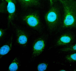 IF analysis of UBE4B using anti-UBE4B antibody (green). UBE4B was detected in an immunocytochemical section of Hela cells. Enzyme antigen retrieval was performed using IHC enzyme antigen retrieval reagent for 15 mins. The cells were blocked with 10% goat serum. And then incubated with 5 ug/ml rabbit anti-UBE4B antibody overnight at 4oC. DyLight 488 Conjugated Goat Anti-Rabbit IgG was used as secondary antibody at 1:500 dilution and incubated for 30 minutes at 37oC. The section was counterstained with DAPI (blue). Visualize using a fluorescence microscope and filter sets appropriate for the label used.