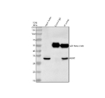Immunoprecipitating NEK7 in Jurkat whole cell lysate. Western blot analysis of NEK7 using anti-NEK7 antibody. Lane 1: Jurkat whole cell lysates (30ug), Lane 2: Rabbit control IgG instead of anti-NEK7 antibody in Jurkat whole cell lysate, Lane 3: anti-NEK7 antibody (2ug) + Jurkat whole cell lysate (500ug). After electrophoresis, proteins were transferred to a membrane. Then the membrane was incubated with rabbit anti-NEK7 antibody at a dilution of 0.5 ug/ml and probed with a goat anti-rabbit IgG-HRP secondary antibody. The signal is developed using ECL Plus Western Blotting Substrate. A specific band was detected for NEK7 at approximately 32 kDa. The expected band size for NEK7 is at 35 kDa.