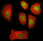 Immunofluorescent staining of NEK7 using anti-NEK7 antibody (green) and anti-Beta Tubulin antibody (red). NEK7 was detected in an immunocytochemical section of SiHa cells. Enzyme antigen retrieval was performed using IHC enzyme antigen retrieval reagent for 15 mins. The cells were blocked with 10% goat serum. And then incubated with 5 ug/ml rabbit anti-NEK7 antibody and mouse anti-Beta Tubulin antibody overnight at 4oC. DyLight 488 Conjugated Goat Anti-Rabbit IgG and Cy3 Conjugated Goat Anti-Mouse IgG were used as secondary antibody at 1:500 dilution and incubated for 30 minutes at 37oC. Visualize using a fluorescence microscope and filter sets appropriate for the label used.
