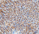 IHC analysis of RAB27B using anti-RAB27B antibody. RAB27B was detected in a paraffin-embedded section of mouse stomach tissue. Heat mediated antigen retrieval was performed in EDTA buffer (pH 8.0, epitope retrieval solution). The tissue section was blocked with 10% goat serum. The tissue section was then incubated with 2 ug/ml rabbit anti-RAB27B antibody overnight at 4oC. Peroxidase Conjugated Goat Anti-rabbit IgG was used as secondary antibody and incubated for 30 minutes at 37oC. The tissue section was developed using an HRP secondary and DAB substrate.