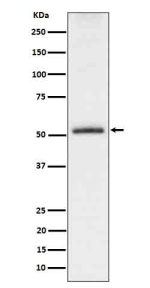 Western blot analysis of Phospho-Tau (S198) expression in mouse hippocampus cell lysate.