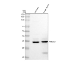 Western blot analysis of ANKRD1 using anti-ANKRD1 antibody. Lane 1: rat heart tissue lysates, Lane 2: mouse heart tissue lysates. After electrophoresis, proteins were transferred to a nitrocellulose membrane at 150 mA for 50-90 minutes. Blocked the membrane with 5% non-fat milk/TBS for 1.5 hour at RT. The membrane was incubated with rabbit anti-ANKRD1 antibody at 0.5 ug/ml overnight at 4oC, then washed with TBS-0.1%Tween 3 times with 5 minutes each and probed with a goat anti-rabbit IgG-HRP secondary antibody at a dilution of 1:5000 for 1.5 hour at RT. The signal was developed using enhanced chemiluminescent. A specific band was detected for ANKRD1 at approximately 36 kDa. The expected band size for ANKRD1 is at 36 kDa.
