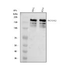 Western blot analysis of NCOA2 using anti-NCOA2 antibody. Electrophoresis was performed on a 8% SDS-PAGE gel at 80V (Stacking gel) / 120V (Resolving gel) for 2 hours. Lane 1: human HEL whole cell lysates, Lane 2: human RT4 whole cell lysates. After electrophoresis, proteins were transferred to a nitrocellulose membrane at 150 mA for 50-90 minutes. Blocked the membrane with 5% non-fat milk/TBS for 1.5 hour at RT. The membrane was incubated with rabbit anti-NCOA2 antibody at 0.5 ug/ml overnight at 4oC, then washed with TBS-0.1%Tween 3 times with 5 minutes each and probed with a goat anti-rabbit IgG-HRP secondary antibody at a dilution of 1:5000 for 1.5 hour at RT. The signal is developed using an ECL Plus Western Blotting Substrate with Tanon 5200 system. The expected band size for NCOA2 is at 159 kDa. The smaller immunoreactive forms (100â120 kDa) are most likely due to proteolytic processing or alternative splicing.