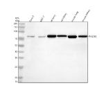 Western blot analysis of PHLDB3 using anti-PHLDB3 antibody. Electrophoresis was performed on a 10% SDS-PAGE gel at 80V (Stacking gel) / 120V (Resolving gel) for 2 hours. Lane 1: human Caco-2 whole cell lysates, Lane 2: human MCF-7 whole cell lysates, Lane 3: rat lung tissue lysates, Lane 4: rat kidney tissue lysates, Lane 5: mouse lung tissue lysates, Lane 6: mouse kidney tissue lysates. After electrophoresis, proteins were transferred to a nitrocellulose membrane at 150 mA for 50-90 minutes. Blocked the membrane with 5% non-fat milk/TBS for 1.5 hour at RT. The membrane was incubated with rabbit anti-PHLDB3 antibody at 0.5 ug/ml overnight at 4oC, then washed with TBS-0.1%Tween 3 times with 5 minutes each and probed with a goat anti-rabbit IgG-HRP secondary antibody at a dilution of 1:5000 for 1.5 hour at RT. The signal was developed using an ECL Plus Western Blotting Substrate. A specific band was detected for PHLDB3 at approximately 72 kDa. The expected band size for PHLDB3 is at 72 kDa.
