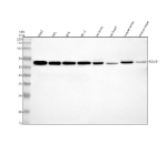 Western blot analysis of SGMS1 using anti-SGMS1 antibody. Electrophoresis was performed on a 12% SDS-PAGE gel at 80V (Stacking gel) / 120V (Resolving gel) for 2 hours. Lane 1: human K562 whole cell lysates, Lane 2: human HEL whole cell lysates, Lane 3: human RT4 whole cell lysates, Lane 4: human PC-3 whole cell lysates, Lane 5: rat testis tissue lysates, Lane 6: rat heart tissue lysates, Lane 7: mouse testis tissue lysates, Lane 8: mouse heart tissue lysates. After electrophoresis, proteins were transferred to a nitrocellulose membrane at 150 mA for 50-90 minutes. Blocked the membrane with 5% non-fat milk/TBS for 1.5 hour at RT. The membrane was incubated with rabbit anti-SGMS1 antibody at 1:1000 overnight at 4oC, then washed with TBS-0.1%Tween 3 times with 5 minutes each and probed with a goat anti-rabbit IgG-HRP secondary antibody at a dilution of 1:5000 for 1.5 hour at RT. The signal was developed using an ECL Plus Western Blotting Substrate. The expected band size for SGMS1 is at ~49 kDa.