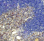 IHC analysis of GIMAP4 using anti-GIMAP4 antibody. GIMAP4 was detected in a paraffin-embedded section of rat thymus tissue. Heat mediated antigen retrieval was performed in EDTA buffer (pH 8.0, epitope retrieval solution). The tissue section was blocked with 10% goat serum. The tissue section was then incubated with 2 ug/ml rabbit anti-GIMAP4 antibody overnight at 4oC. Peroxidase Conjugated Goat Anti-rabbit IgG was used as secondary antibody and incubated for 30 minutes at 37oC. The tissue section was developed using an HRP secondary and DAB substrate.