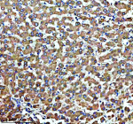 IHC analysis of SUCO using anti-SUCO antibody. SUCO was detected in a paraffin-embedded section of human liver tissue. Heat mediated antigen retrieval was performed in EDTA buffer (pH 8.0, epitope retrieval solution). The tissue section was blocked with 10% goat serum. The tissue section was then incubated with 2 ug/ml rabbit anti-SUCO antibody overnight at 4oC. Peroxidase Conjugated Goat Anti-rabbit IgG was used as secondary antibody and incubated for 30 minutes at 37oC. The tissue section was developed using an HRP secondary and DAB substrate.