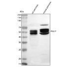 Western blot analysis of Pancreatic Lipase using anti-PNLIP antibody. Lane 1: rat pancreas tissue lysates, Lane 2: mouse pancreas tissue lysates. After electrophoresis, proteins were transferred to a nitrocellulose membrane at 150 mA for 50-90 minutes. Blocked the membrane with 5% non-fat milk/TBS for 1.5 hour at RT. The membrane was incubated with rabbit anti-PNLIP antibody at 0.5 ug/ml overnight at 4oC, then washed with TBS-0.1%Tween 3 times with 5 minutes each and probed with a goat anti-rabbit IgG-HRP secondary antibody at a dilution of 1:5000 for 1.5 hour at RT. The signal was developed using enhanced chemiluminescent. The expected band size for PNLIP is at 51 kDa and the protein is often observed as several closely migrating glycoforms. This is more pronounced in rodent samples than human samples.