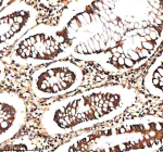 IHC analysis of NEK9 using anti-NEK9 antibody. NEK9 was detected in a paraffin-embedded section of human colon tissue. Heat mediated antigen retrieval was performed in EDTA buffer (pH 8.0, epitope retrieval solution). The tissue section was blocked with 10% goat serum. The tissue section was then incubated with 2 ug/ml rabbit anti-NEK9 antibody overnight at 4oC. Peroxidase Conjugated Goat Anti-rabbit IgG was used as secondary antibody and incubated for 30 minutes at 37oC. The tissue section was developed using an HRP secondary and DAB substrate.
