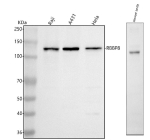 Western blot analysis of RBBP8 using anti-RBBP8 antibody. Lane 1: human Raji whole cell lysates, Lane 2: human whole cell lysates, Lane 3: human Hela whole cell lysates, Lane 4: mouse testis tissue lysates. After electrophoresis, proteins were transferred to a nitrocellulose membrane at 150 mA for 50-90 minutes. Blocked the membrane with 5% non-fat milk/TBS for 1.5 hour at RT. The membrane was incubated with rabbit anti-RBBP8 antibody at 0.5 ug/ml overnight at 4oC, then washed with TBS-0.1%Tween 3 times with 5 minutes each and probed with a goat anti-rabbit IgG-HRP secondary antibody at a dilution of 1:5000 for 1.5 hour at RT. The signal was developed using enhanced chemiluminescent. The expected band size for RBBP8 is at 102 kDa but the protein can be observed at 125-135 kDa as a singlet or doublet, due to phosphorylation.