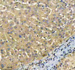 IHC analysis of TOP1MT using anti-TOP1MT antibody. TOP1MT was detected in a paraffin-embedded section of human liver tissue. Heat mediated antigen retrieval was performed in EDTA buffer (pH 8.0, epitope retrieval solution). The tissue section was blocked with 10% goat serum. The tissue section was then incubated with 2 ug/ml rabbit anti-TOP1MT antibody overnight at 4oC. Peroxidase Conjugated Goat Anti-rabbit IgG was used as secondary antibody and incubated for 30 minutes at 37oC. The tissue section was developed using an HRP secondary and DAB substrate.
