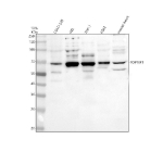 Western blot analysis of TOP1MT using anti-TOP1MT antibody. Electrophoresis was performed on a 10% SDS-PAGE gel at 80V (Stacking gel) / 120V (Resolving gel) for 2 hours. Lane 1: human COLO-320 whole cell lysates, Lane 2: human HEL whole cell lysates, Lane 3: human THP-1 whole cell lysates, Lane 4: human K562 whole cell lysates, Lane 5: rat herat tissue lysates. After electrophoresis, proteins were transferred to a nitrocellulose membrane at 150 mA for 50-90 minutes. Blocked the membrane with 5% non-fat milk/TBS for 1.5 hour at RT. The membrane was incubated with rabbit anti-TOP1MT antibody at 0.5 ug/ml overnight at 4oC, then washed with TBS-0.1%Tween 3 times with 5 minutes each and probed with a goat anti-rabbit IgG-HRP secondary antibody at a dilution of 1:5000 for 1.5 hour at RT. The signal was developed using an ECL Plus Western Blotting Substrate. A specific band was detected for TOP1MT at approximately 70 kDa. The expected band size for TOP1MT is at 70 kDa.