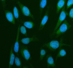 Immunofluorescent staining of GANAB using anti-GANAB antibody (green). GANAB was detected in an immunocytochemical section of HELA cells. Enzyme antigen retrieval was performed using IHC enzyme antigen retrieval reagent for 15 mins. The cells were blocked with 10% goat serum. And then incubated with 5 ug/ml rabbit anti-GANAB antibody overnight at 4oC. DyLight 488 Conjugated Goat Anti-Rabbit IgG was used as secondary antibody at 1:500 dilution and incubated for 30 minutes at 37oC. The section was counterstained with DAPI (blue). Visualize using a fluorescence microscope and filter sets appropriate for the label used.