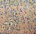 IHC analysis of KCNA6 using anti-KCNA6 antibody. KCNA6 was detected in a paraffin-embedded section of mouse brain tissue. Heat mediated antigen retrieval was performed in EDTA buffer (pH 8.0, epitope retrieval solution). The tissue section was blocked with 10% goat serum. The tissue section was then incubated with 2 ug/ml rabbit anti-KCNA6 antibody overnight at 4oC. Peroxidase Conjugated Goat Anti-rabbit IgG was used as secondary antibody and incubated for 30 minutes at 37oC. The tissue section was developed using an HRP secondary and DAB substrate.